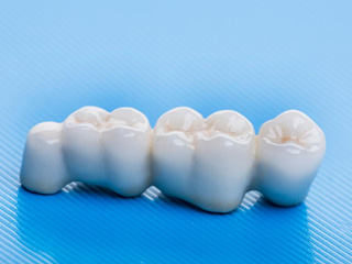 An example of a dental bridge on a light blue table  