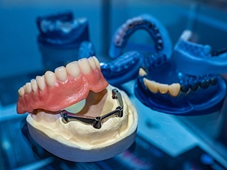 implant dentures on table 