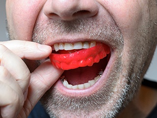 man putting on mouthguard