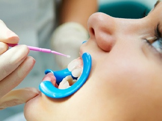 A woman receiving teeth whitening treatment.