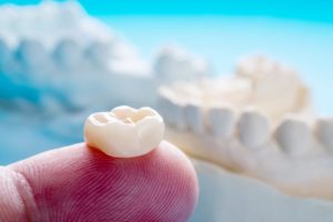 how long do dental crowns last restoration on dentist fingertip