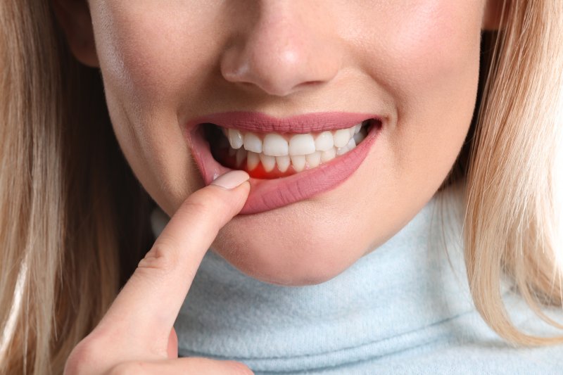 young woman pointing to inflamed gum