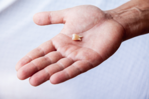 a closeup of a hand holding a lost tooth